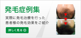 発毛症例集